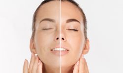 Servicii Estetica Medicala || Centrul Fericirii